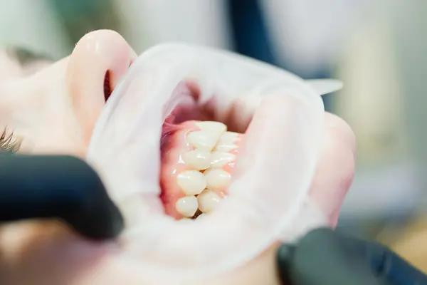 ¿Deseas tener una sonrisa impecable? Descubre para qué sirven las carillas dentales en este blog. Desde solucionar defectos dentales hasta mejorar tanto la forma como la...